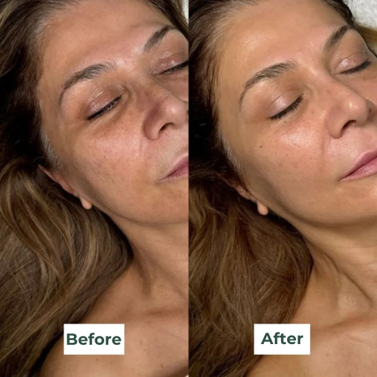 Bio-Collagen Mask