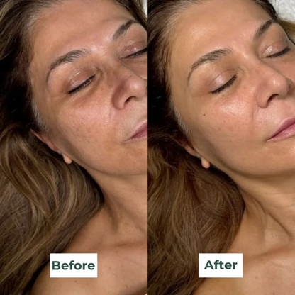 Bio-Collagen Mask